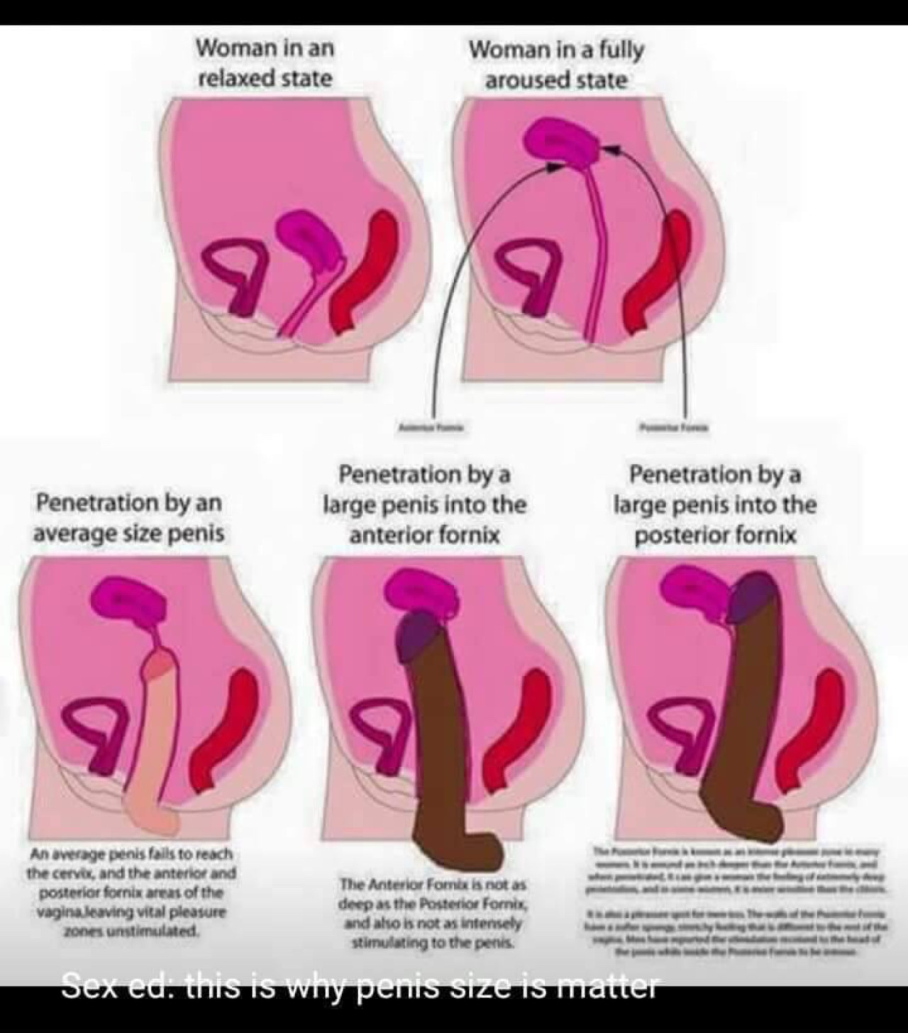 Cervix penetration compilation
