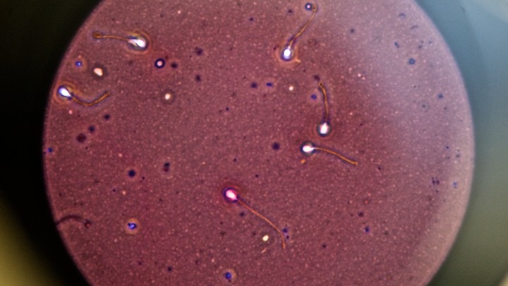 4-Wheel D. reccomend Sperm under a microcsope
