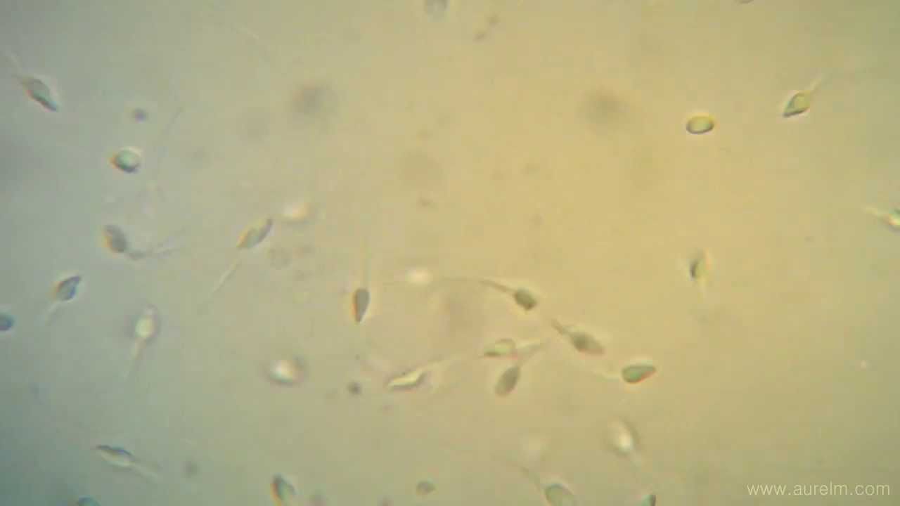Sperm under a microcsope