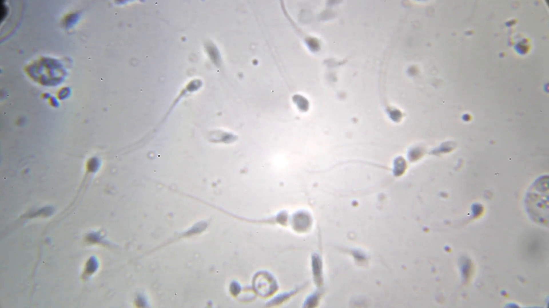 best of A microcsope under Sperm