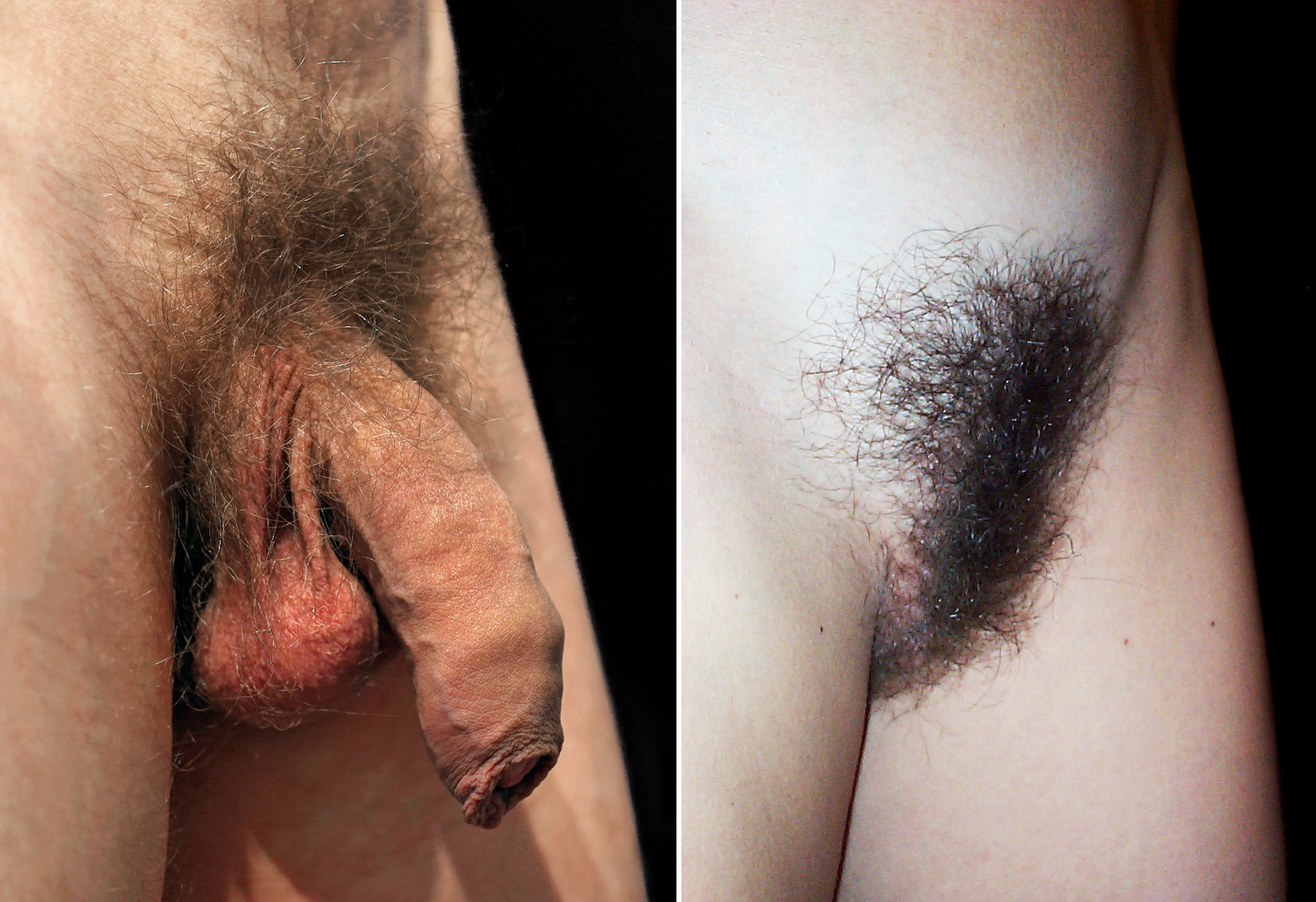 Picture of a shaved groin