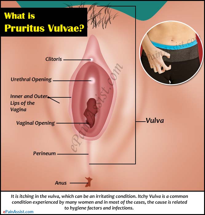 best of And pictures vulva itching Severe
