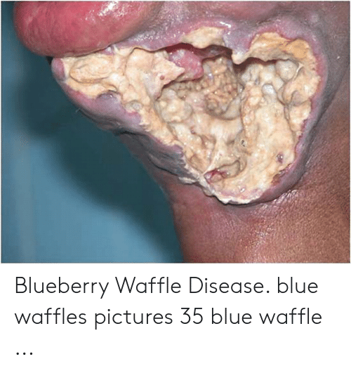 Blueberry waffle pussy