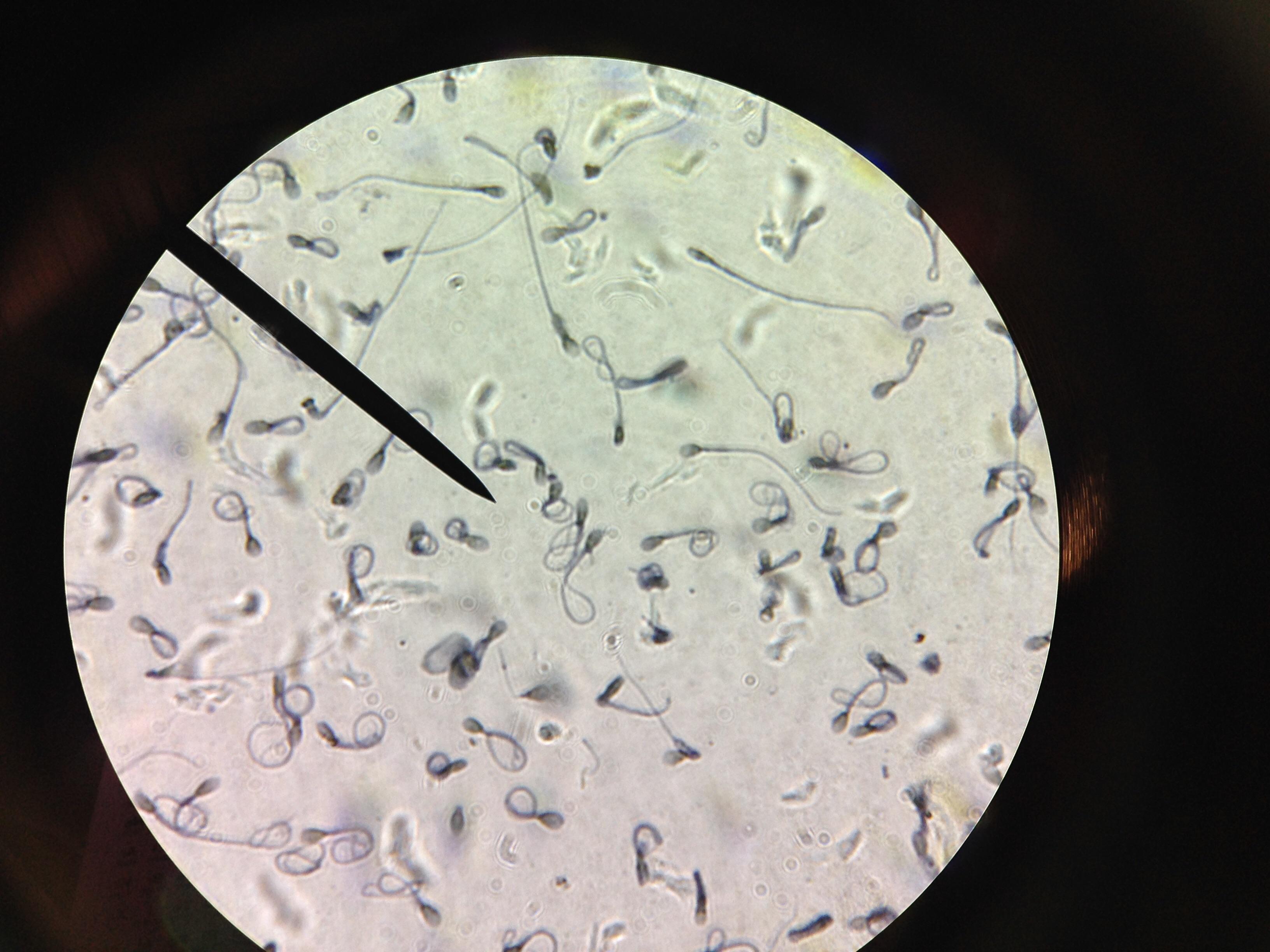 Sperm under a microcsope