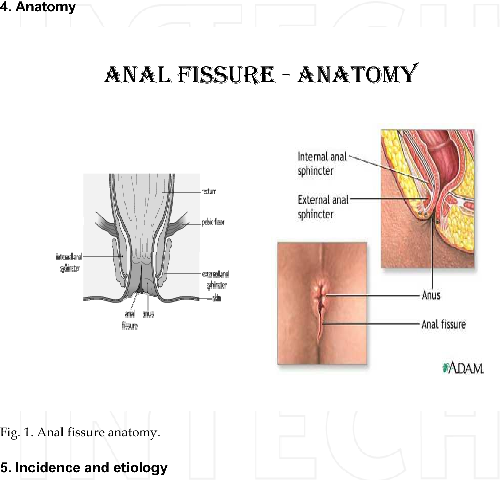 best of Specialist Anal fissure