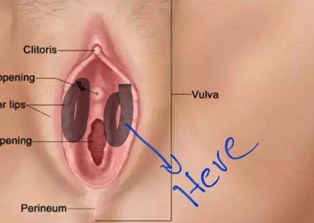 Bumps near opening of vagina