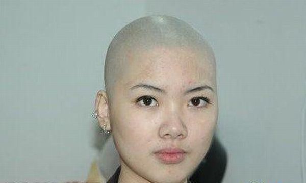 Bald asian girl