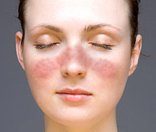 Facial skin allergies