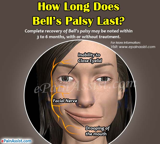 best of Medication Facial paralysis