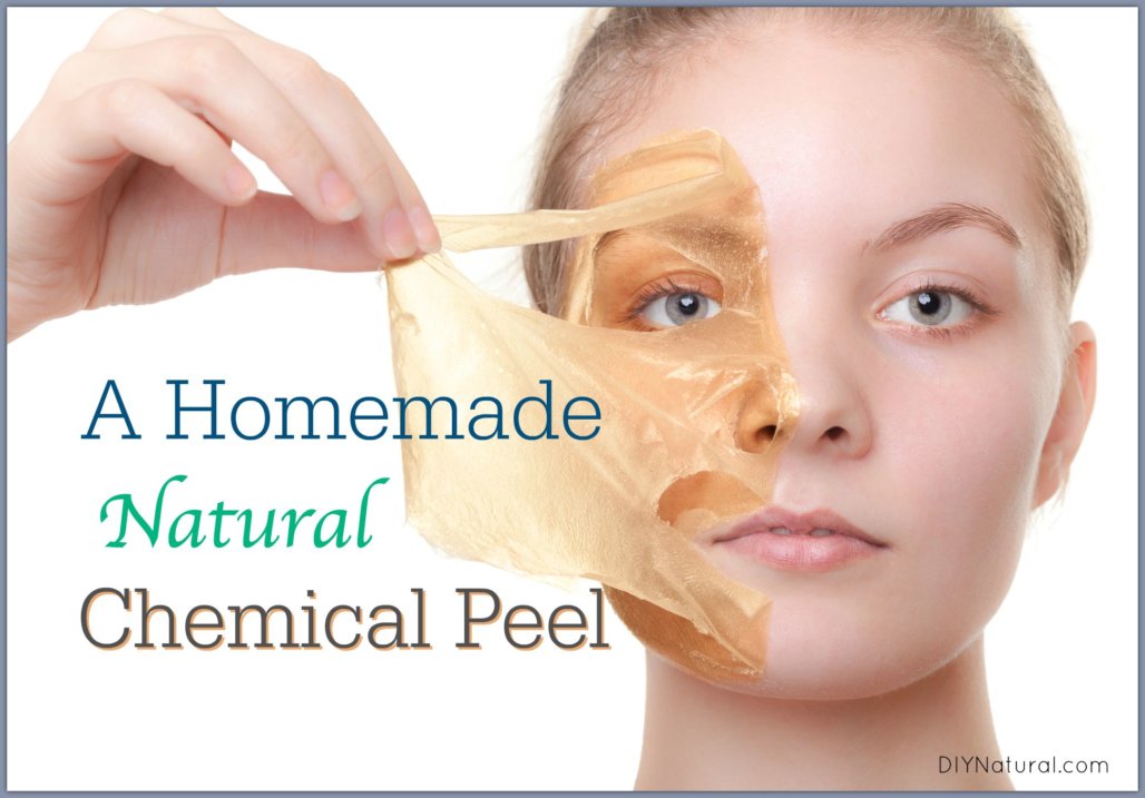 Cherry P. recommendet Facial peel formula