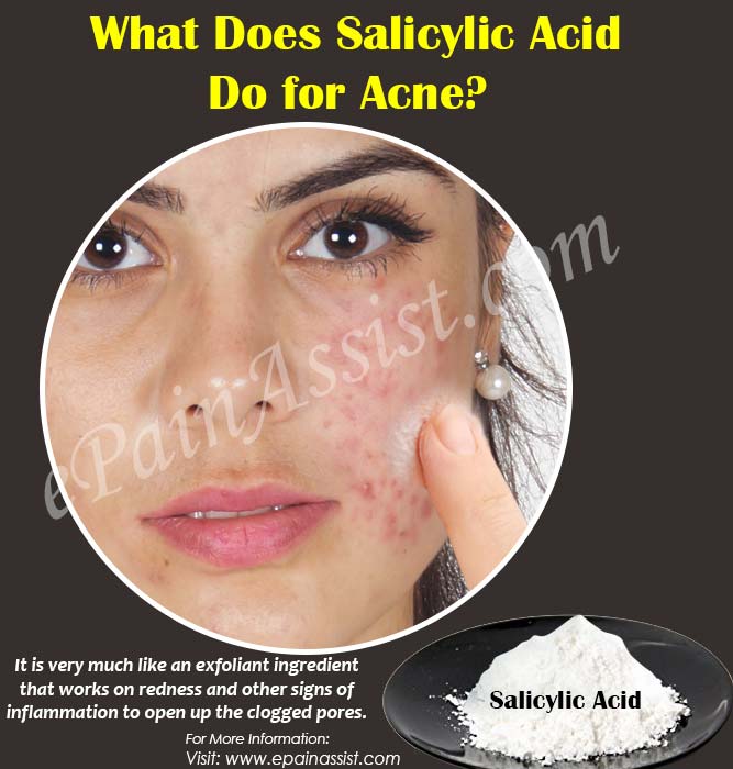 8-track reccomend Salicylic acid facial nerves