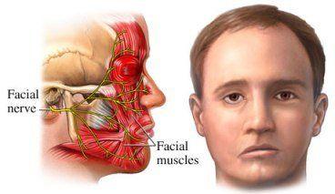 Quarterback recomended Facial muscle spasm