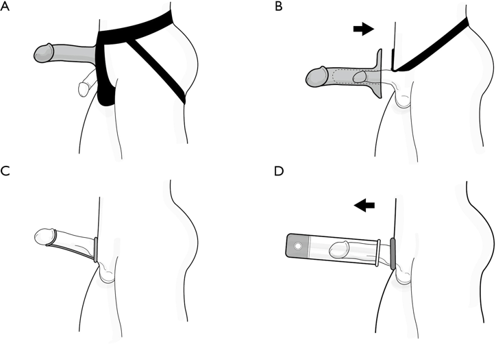 best of Sexual prosthesis on male Strap