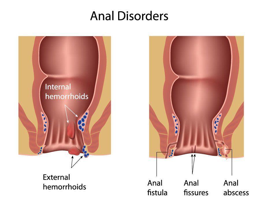 See inside anal