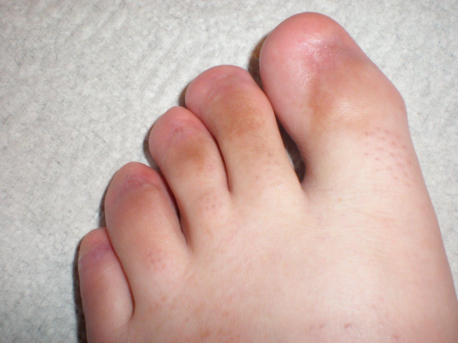 Ebony bare feet and toe fetish