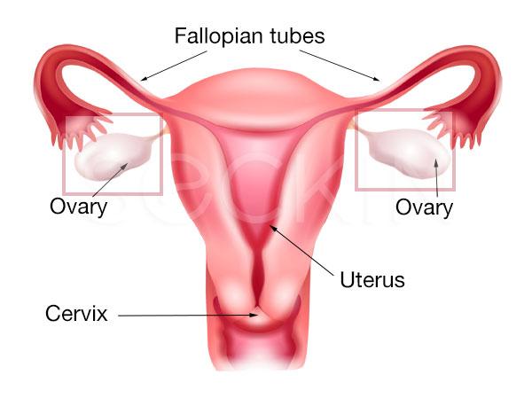 best of Ovarian cause cyst bust sex a Does to