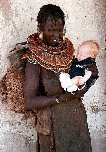 best of Tribe Albino girls african