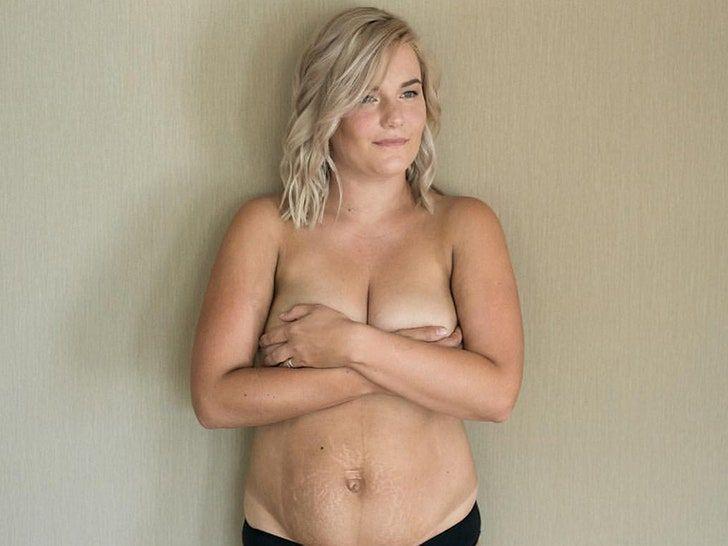 Huge nipples during pregnancy