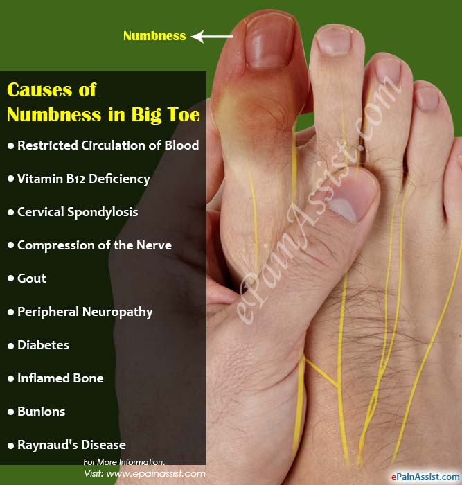 Engineer recommend best of foot numbness Bottom