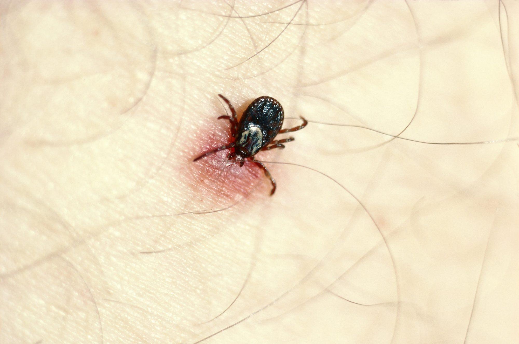 Fun facts about ticks