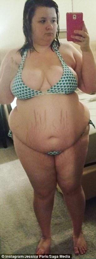Naked teen with stretch marks