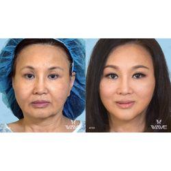Ella reccomend California cosmetic facial surgery