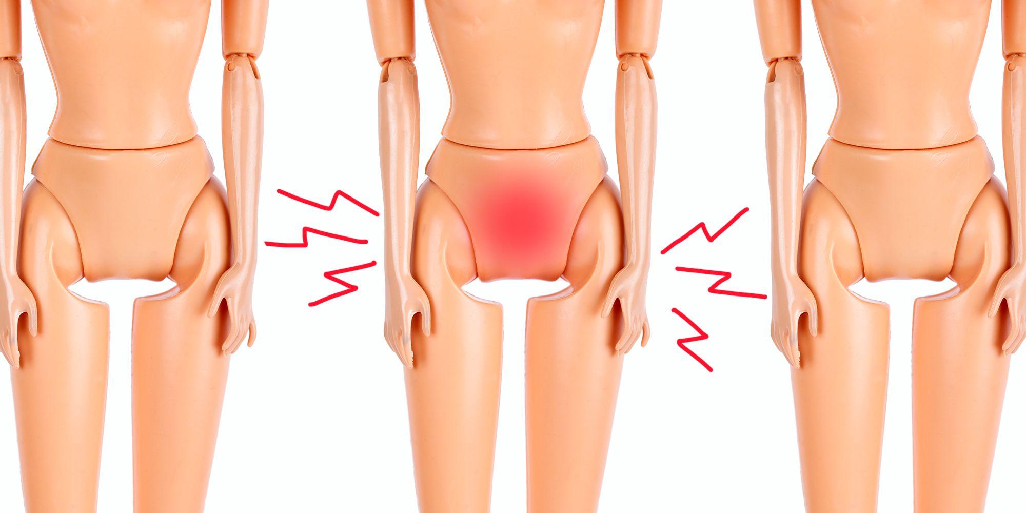 Why do women scratch their vulva