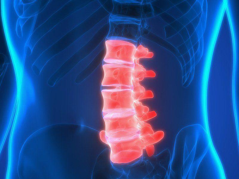 Spinal cord stimulator orgasm