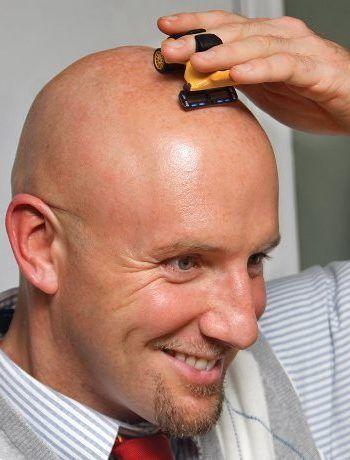 Balding vs shaved head