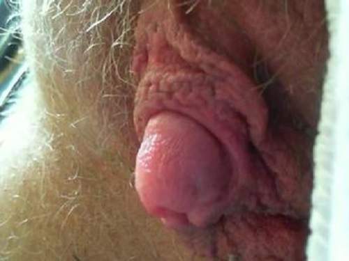 Hairy Giant Clit