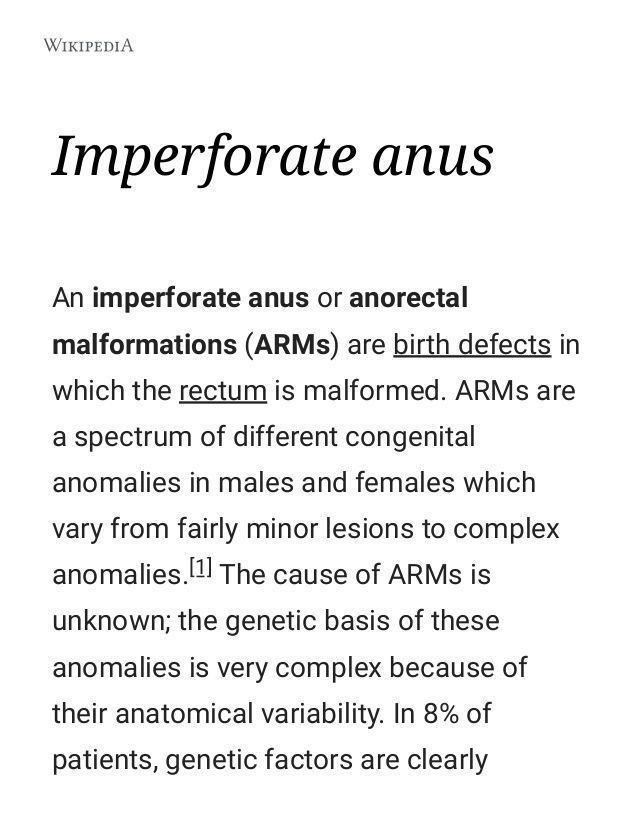 best of Defects with imperforate anus Birth present
