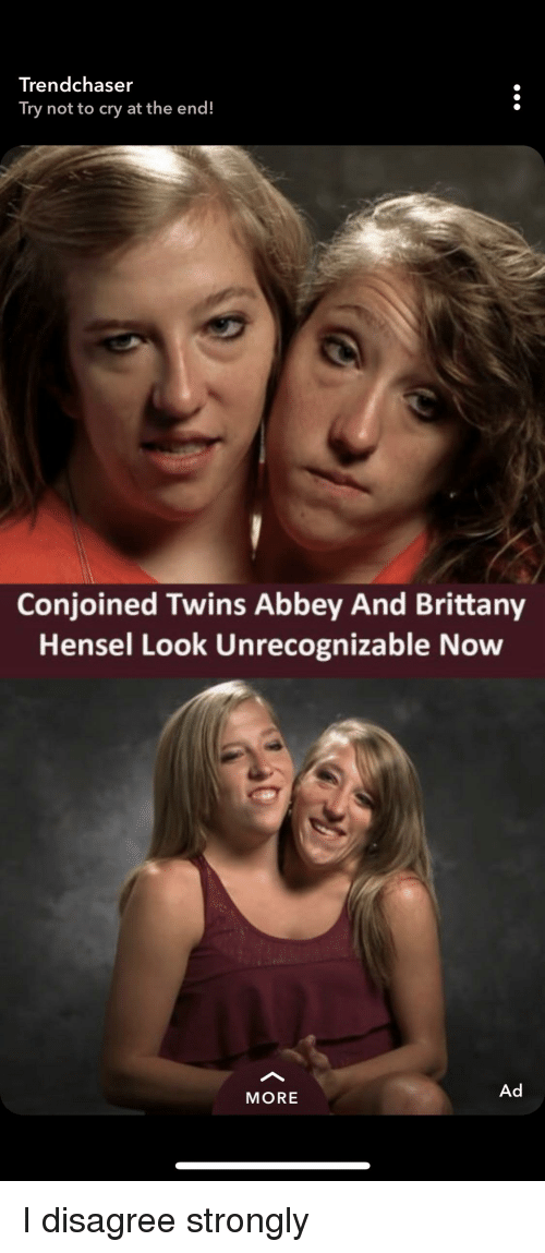 Red Z. reccomend Siamese twins joke video