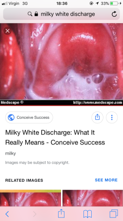 Creamy white vagina