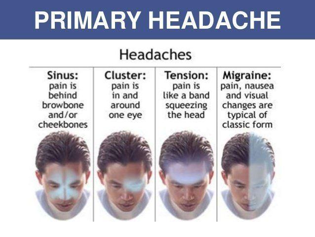 Rebound headaches facial pain