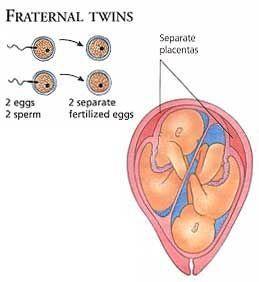 How twins two sperm one egg