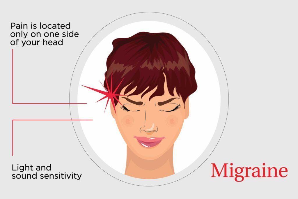 best of And head pain Facial