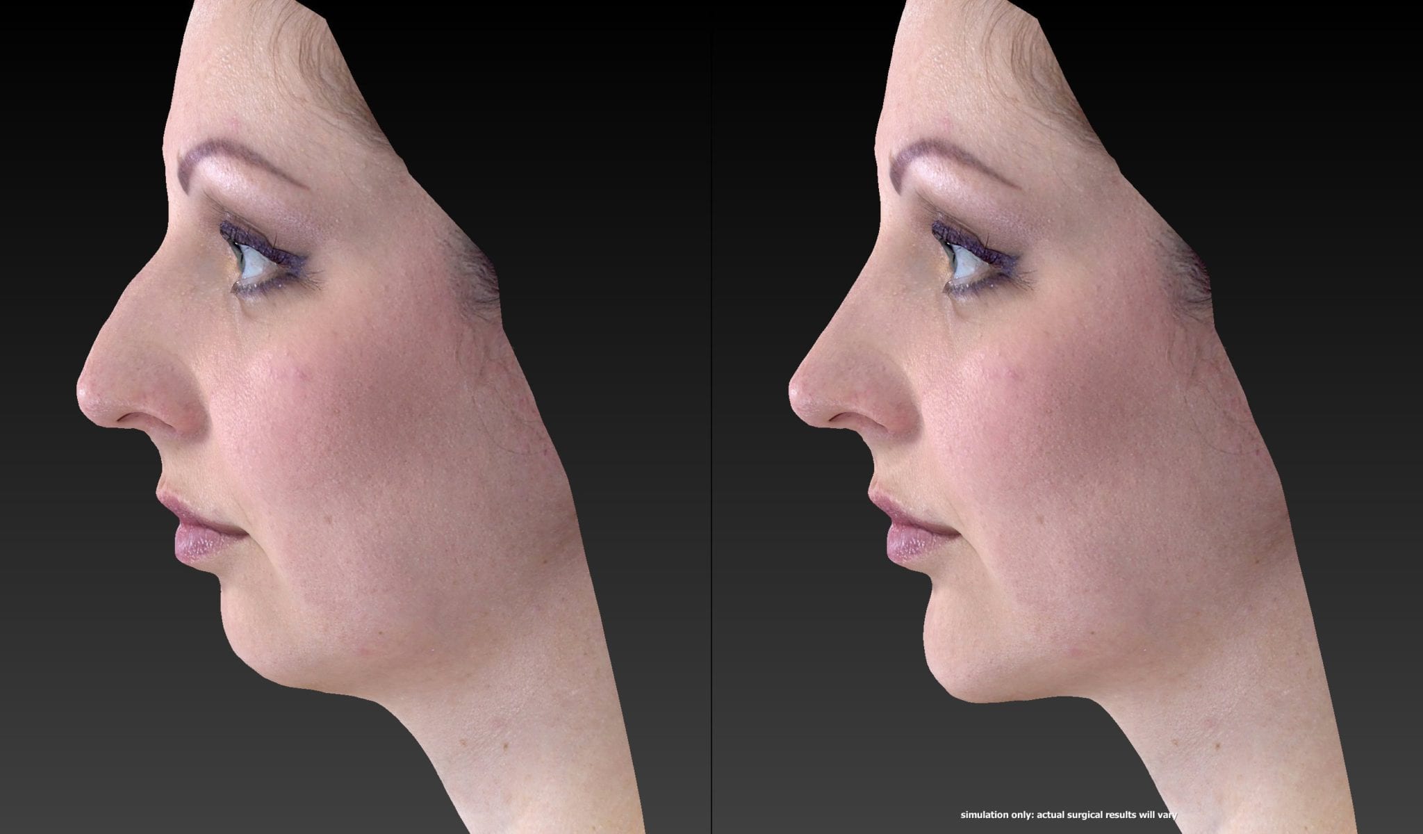 Facial imaging cosmetic surgery