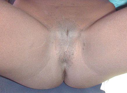 best of Circumsion pussy pics Female