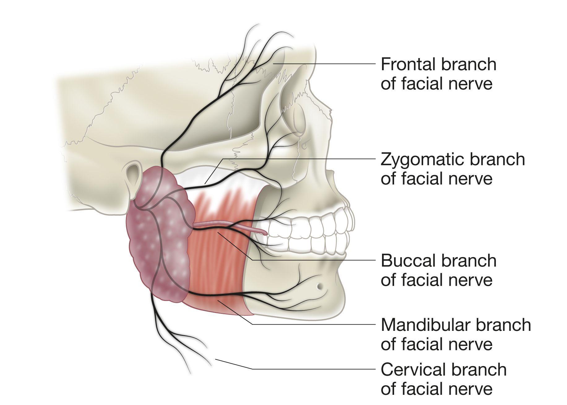best of Facial nerve injury Iatrogenic