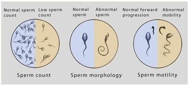 Low sperm count due to masturbation