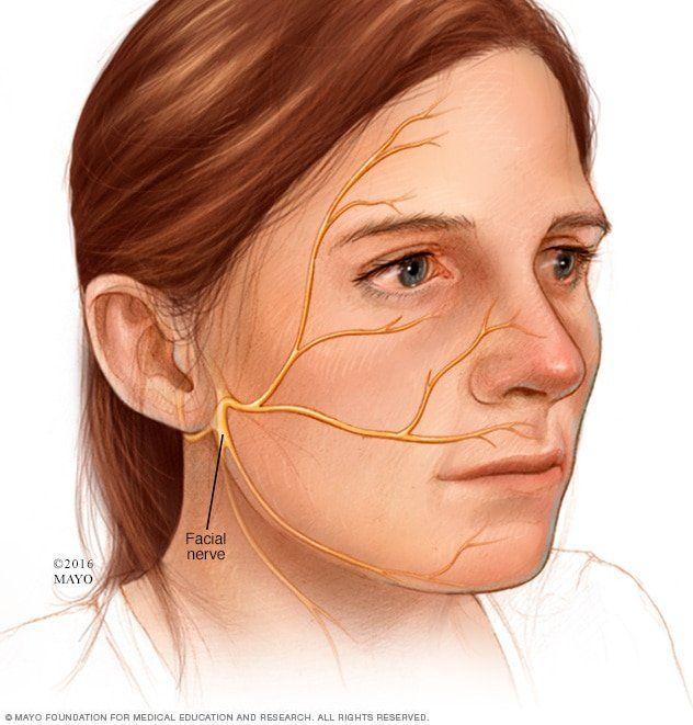 best of Facial pain syndrome Mayo