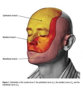 The M. reccomend Trigeminal nerve facial nerve