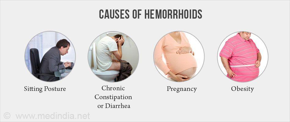 Women with hemorrhoids in public